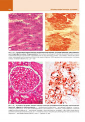 Патологическая анатомия. Атлас. Том 1. Общая патологическая анатомия - Фото 10