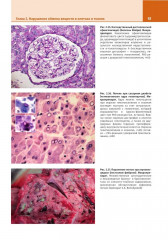 Патологическая анатомия. Атлас. Том 1. Общая патологическая анатомия - Фото 11
