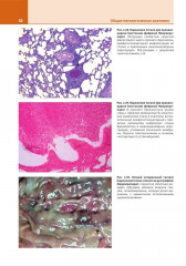 Патологическая анатомия. Атлас. Том 1. Общая патологическая анатомия - Фото 12