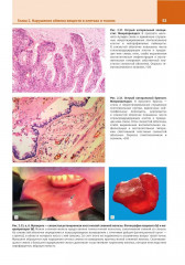 Патологическая анатомия. Атлас. Том 1. Общая патологическая анатомия - Фото 13