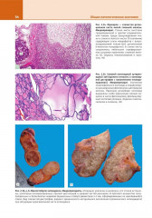 Патологическая анатомия. Атлас. Том 1. Общая патологическая анатомия - Фото 14