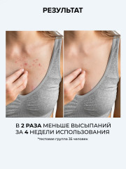 Мыло скрабирующее для тела «Anti-Breakout Exfoliating Body Bar» - Фото 4