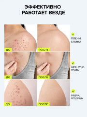 Мыло скрабирующее для тела «Anti-Breakout Exfoliating Body Bar» - Фото 5