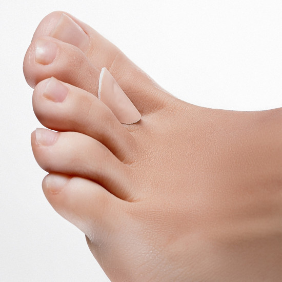 Пластырь с салициловой кислотой для лечения «сухих» мозолей