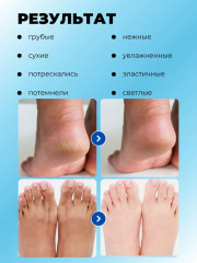 Набор увлажняющих масок для ног с клубникой - Фото 3
