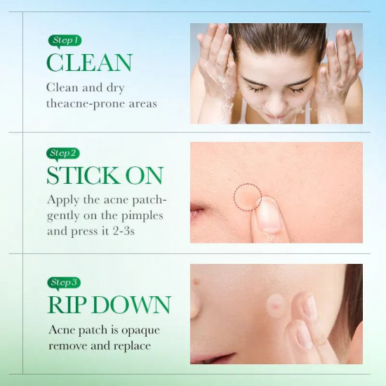 Патчи для лица против воспалений «Acne Patch»