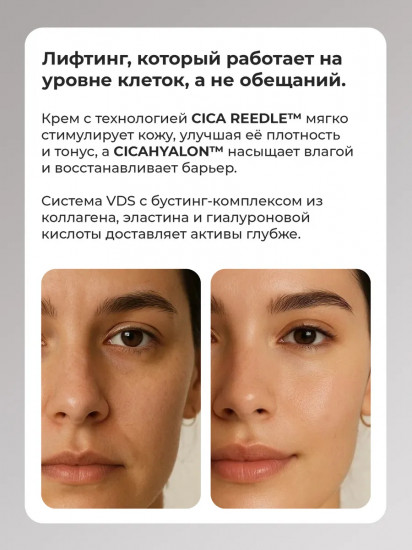Лифтинг крем с микроиглами «Reedle Shot Lifting Cream»