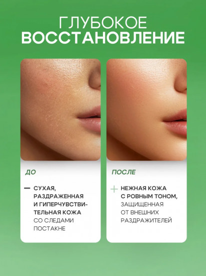 Крем для лица восстанавливающий с центеллой и ниацинамидом «Cica + Niacinamide»