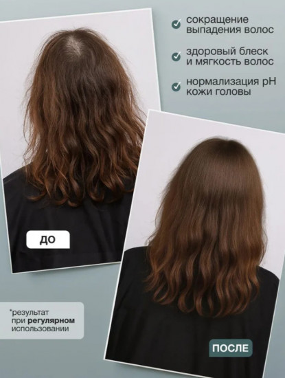 Набор-комплекс для роста волос