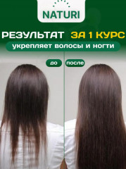 Коллаген для суставов - Фото 7