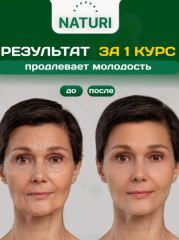 Коллаген для суставов - Фото 8