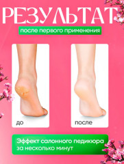 Нано-терка педикюрная - Фото 3