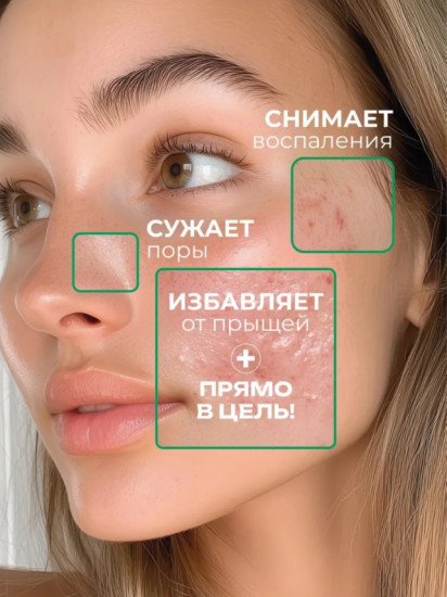 Крем точечный от прыщей «Salicylic Acid Acne Removal»