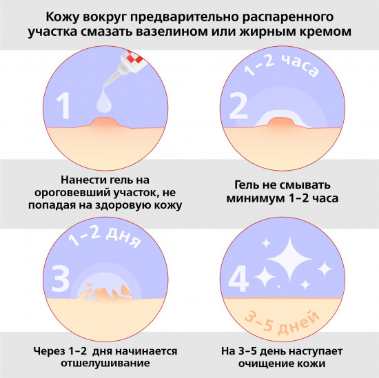 Гель косметический для удаления бородавок и папиллом «Суперчистотело»
