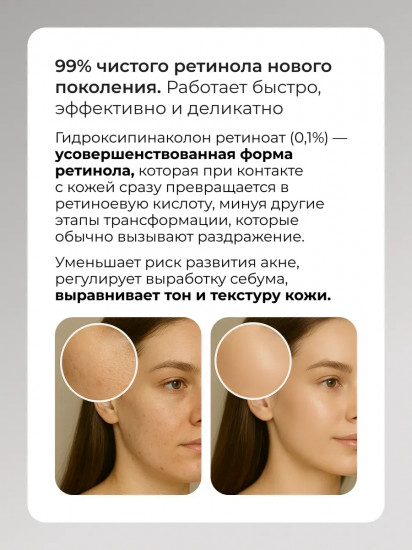 Эссенция с ретинолом и центеллой Cica Reti-A Essence 0.1