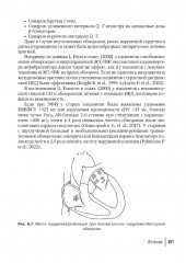 Аритмии сердца. Руководство для врачей - Фото 2