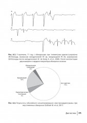 Аритмии сердца. Руководство для врачей - Фото 8