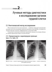 Лучевая диагностика органов грудной клетки у взрослых и детей - Фото 4