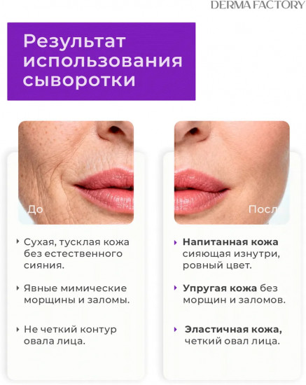 Сыворотка для лица антивозрастная двухфазная с Volufiline 5%