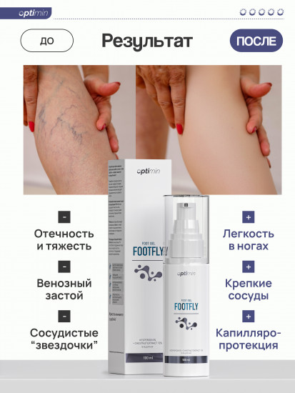Гель для ног от варикоза «Footfly»