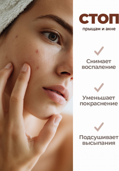 Болтушка от прыщей для лица «Монастырская с цинком»