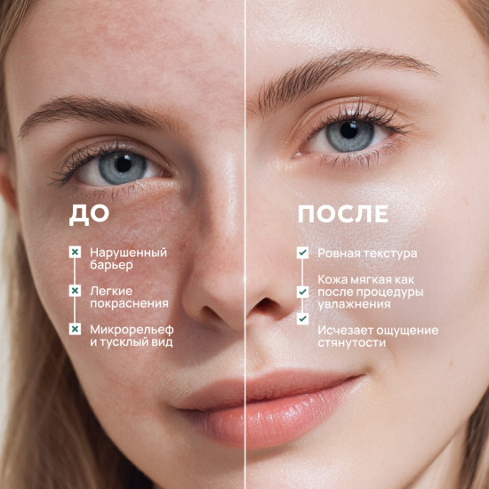 Крем липидовосстанавливающий с церамидами для лица