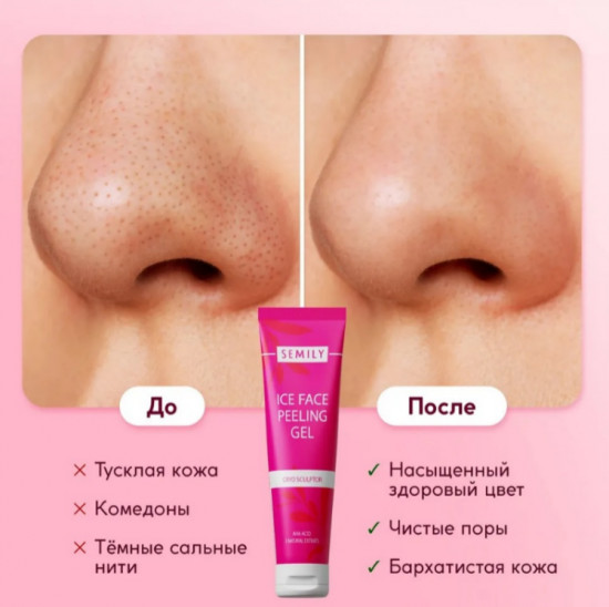 Кислотный пилинг-скатка для лица