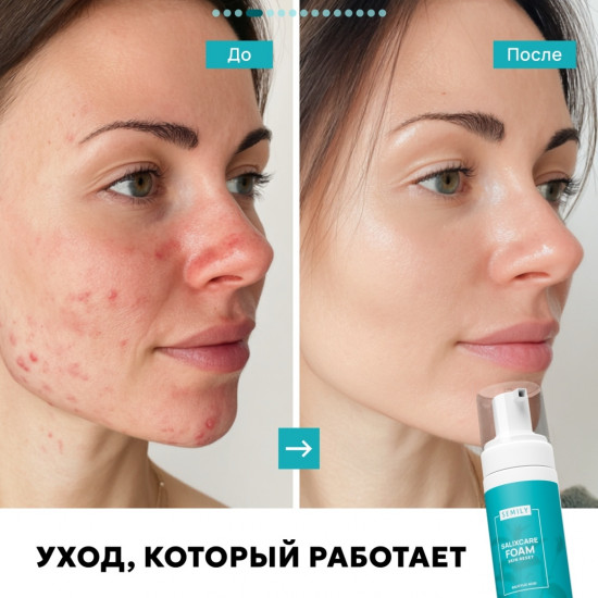 Пенка для умывания с салициловой кислотой