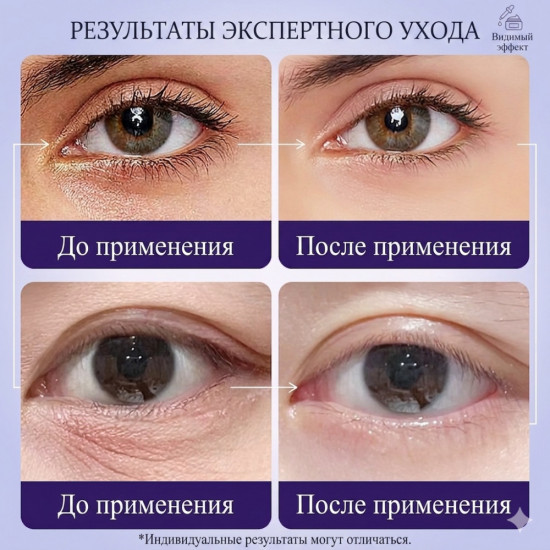 Омолаживающий крем для кожи вокруг глаз с экстрактом виноградных косточек от морщин и темных кругов