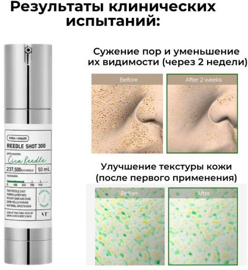 Сыворотка «Cica Reedle Shot 300»