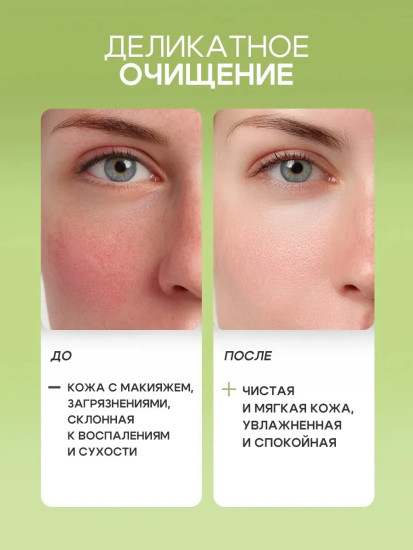Мицеллярная ромашковая вода