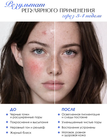 Пилинг-тонер для лица с AHA- и BHA-кислотами «AHA + BHA Pore Clearing»
