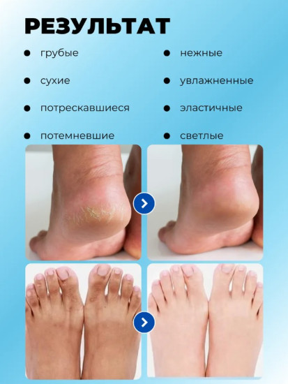 Набор увлажняющих масок для ног с вишней