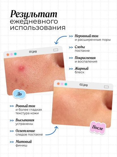 Крем для проблемной кожи лица увлажняющий «Relief Moisturizer»