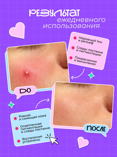 Крем для лица с комплексом кислот и цинком «Acids Complex and Zinc Renewal Face Cream»