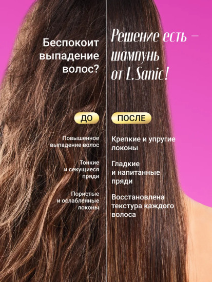 Шампунь для волос от перхоти с кератином «Dandruff Shampoo»