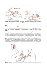 Эндоскопия ЖКТ. Основные техники и методики. Практическое руководство по Коттону и Уильямсу - Фото 3