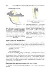 Эндоскопия ЖКТ. Основные техники и методики. Практическое руководство по Коттону и Уильямсу - Фото 4