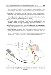 Эндоскопия ЖКТ. Основные техники и методики. Практическое руководство по Коттону и Уильямсу - Фото 5