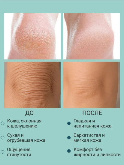 Крем смягчающий для пяток и локтей №13