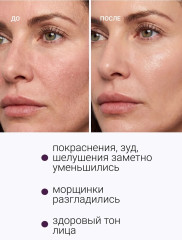 Сыворотка для восстановления липидного барьера и коррекции возрастных изменений кожи лица №89 - Фото 3
