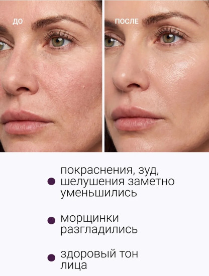 Сыворотка для восстановления липидного барьера и коррекции возрастных изменений кожи лица №89
