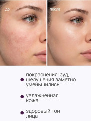 Сыворотка для регенерации кожи лица успокаивающая №82 - Фото 3