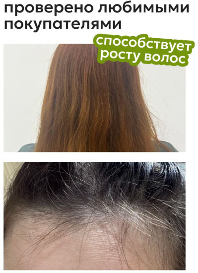 Масло для роста волос с розмарином «Rosemary Hair Oil»