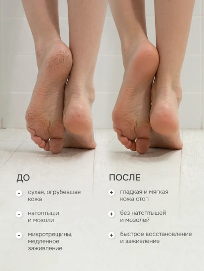 Крем для ног с мочевиной