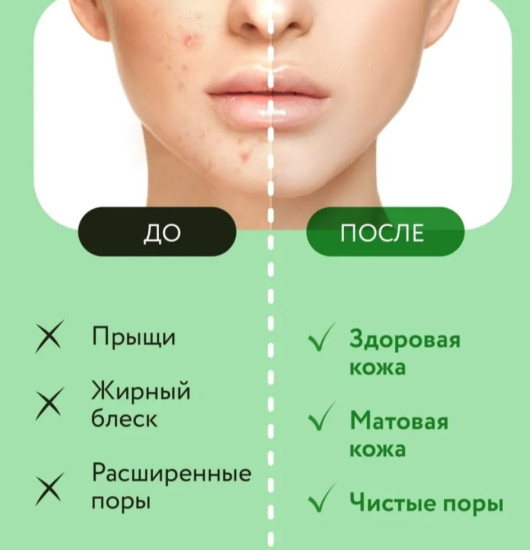 Очищающая пенка от прыщей и акне с кислотами для проблемной кожи эффективное очищающее средство