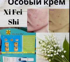 Крем для лица от прыщей и угрей - Фото 4