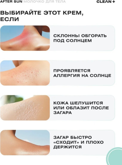 Молочко после загара для тела «After Sun»