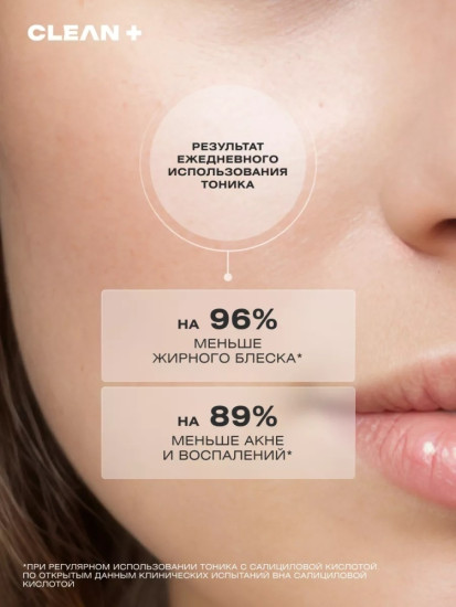 Тоник для лица от прыщей «Acne Control»