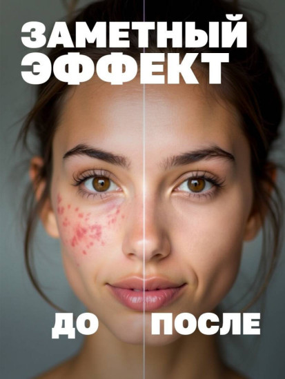 Болтушка с цинком, от прыщей, 100мл